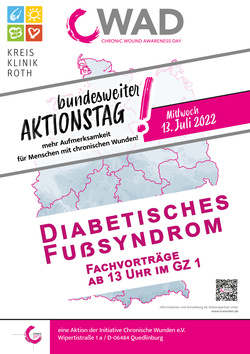 Das Diabetische Fußsyndrom - Aktionstag am 13.7.